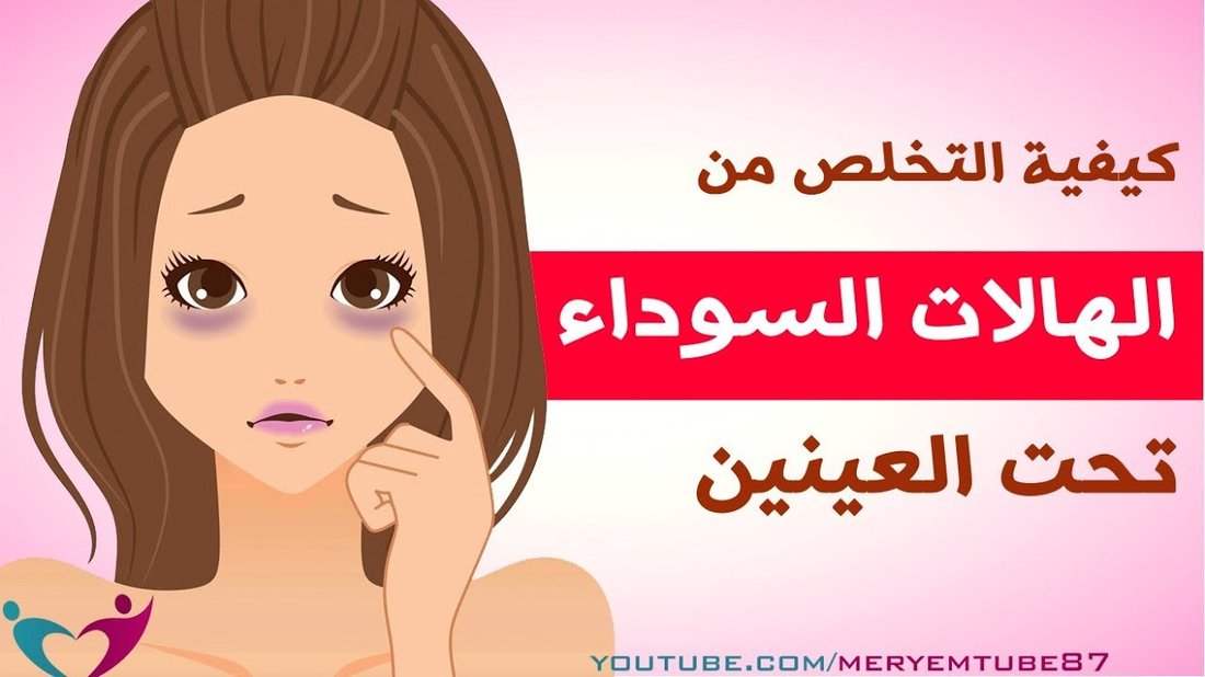كيفية التخلص من الهالات السوداء تحت العين في وقت قصير