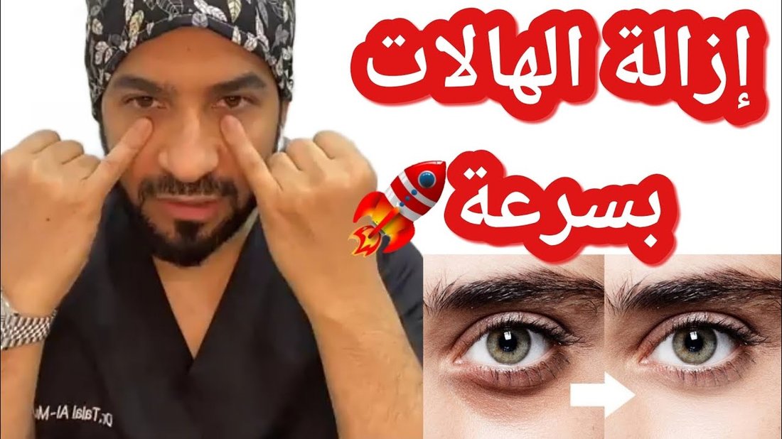كيفية التخلص من الهالات السوداء تحت العين في وقت قصير