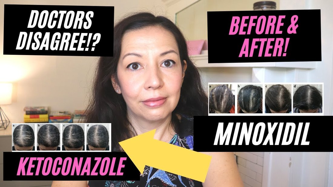 Why Your Current Shampoo is Causing Hair Loss and What to Use Instead