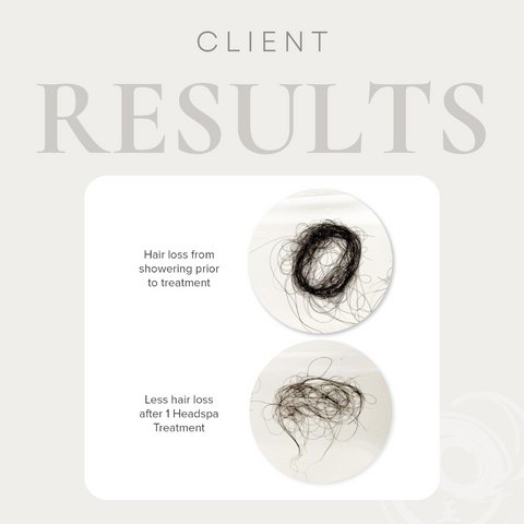 Why Your Current Shampoo is Causing Hair Loss and What to Use Instead