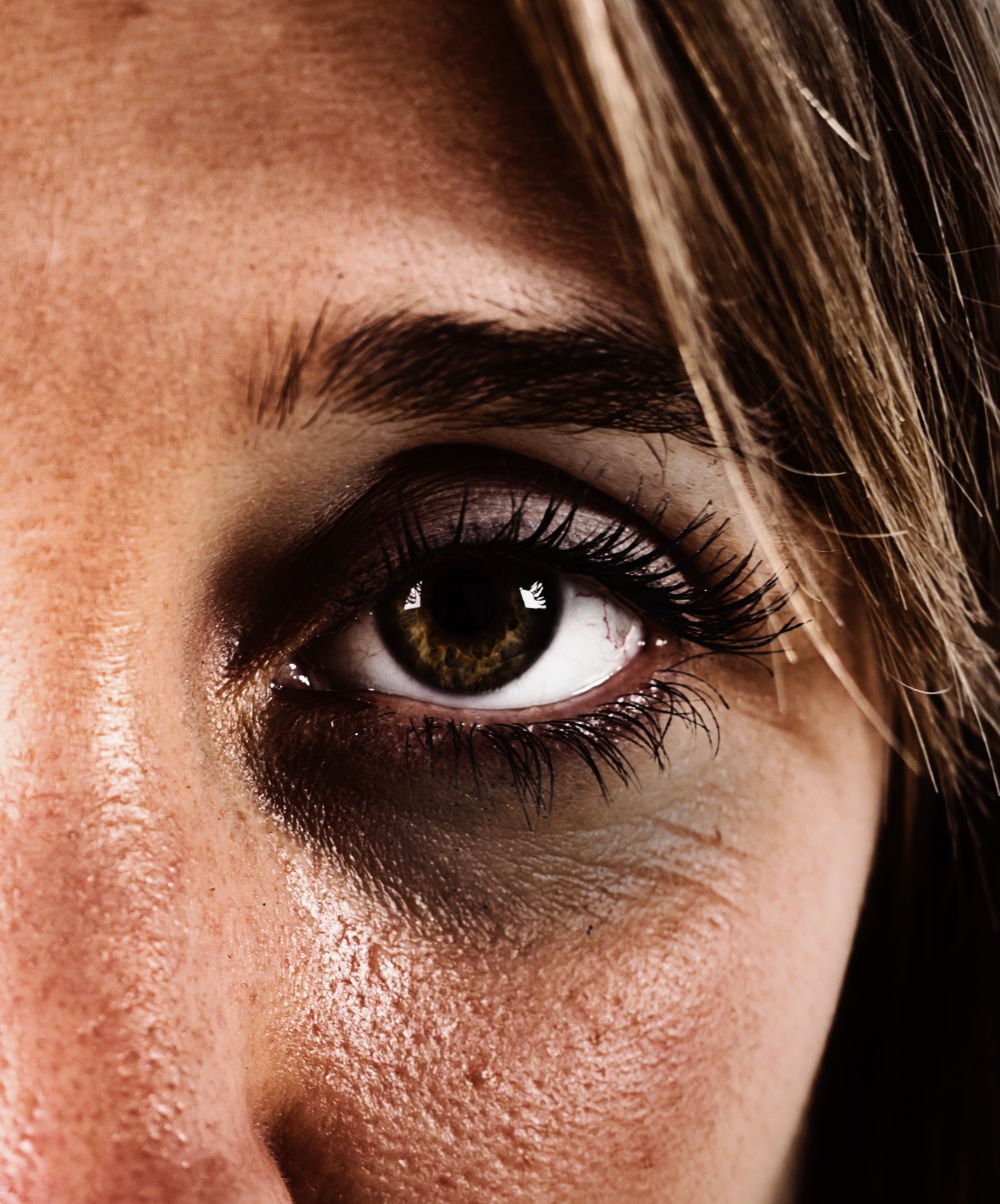 The Root Causes of Dark Under Eye Circles and Permanent Home Remedies