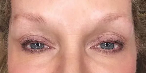 The Real Cause of Eyebrow Thinning and How to Regrow Them Naturally
