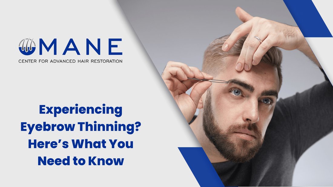 The Real Cause of Eyebrow Thinning and How to Regrow Them Naturally
