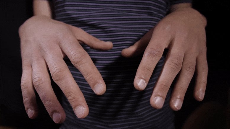 Causes of Hand Tremors in Young Adults and When to See a Specialist